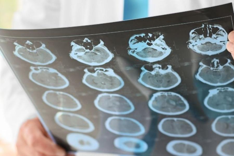 Hero Updated Neurology