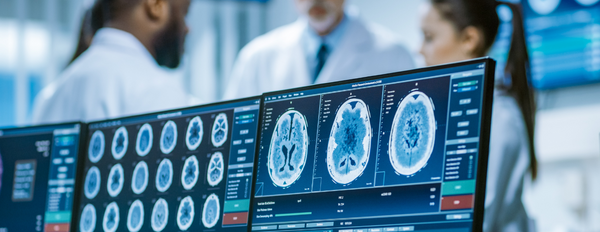 Scans of brain displayed on screen, group of doctors in background